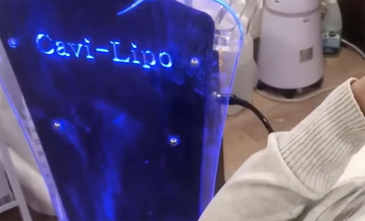 Cavi Lipo | Skin Solution Spa